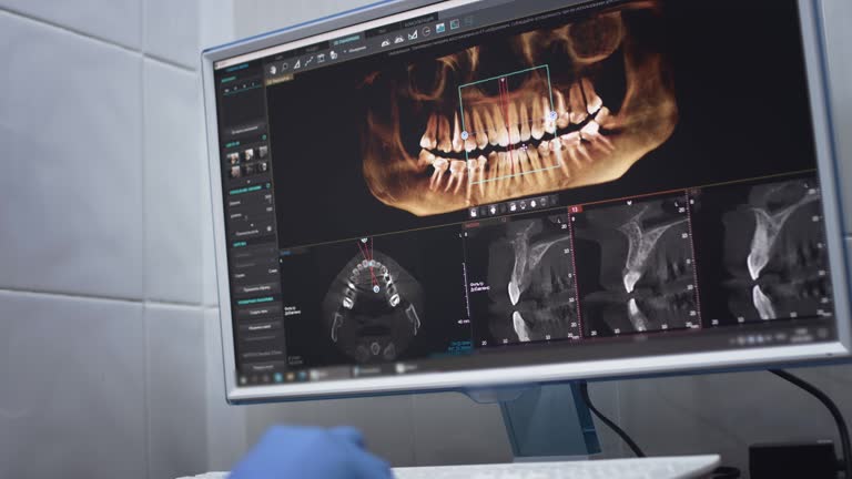 Full Mouth Reconstruction in Higganum, CT